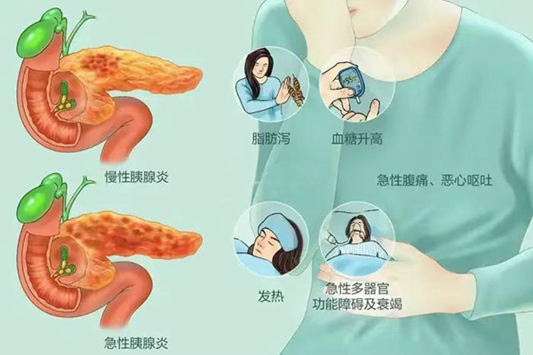 急性胰腺炎發(fā)病征兆。重醫(yī)附屬兒童醫(yī)院供圖