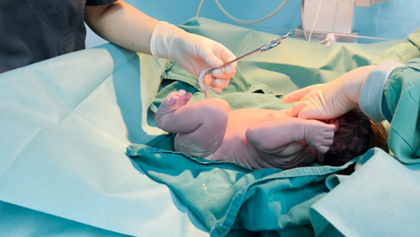 醫(yī)生為胎兒輸臍血。重慶安琪兒婦產(chǎn)醫(yī)院供圖