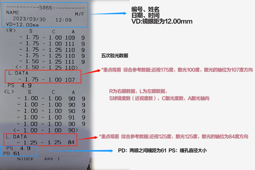 視力數(shù)據(jù)的含義。重慶普瑞眼科醫(yī)院供圖