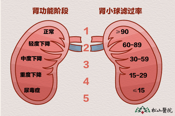 腎功能階段。重慶松山醫(yī)院供圖