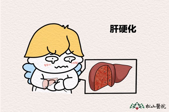 肝硬化。重慶松山醫(yī)院供圖