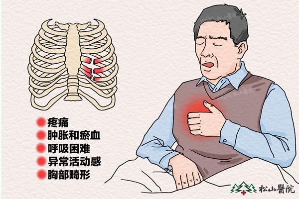肋骨骨折癥狀。重慶松山醫(yī)院供圖