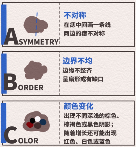 五步法（一）。重慶松山醫(yī)院供圖