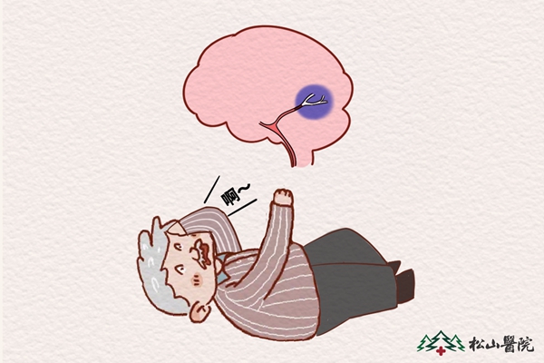 腦卒中。重慶松山醫(yī)院供圖