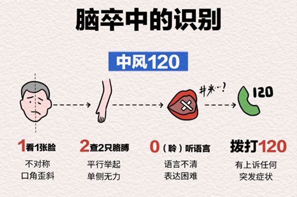 “中風120”口訣。重慶松山醫(yī)院供圖