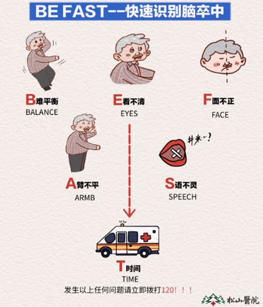 “BE FAST”口訣。重慶松山醫(yī)院供圖