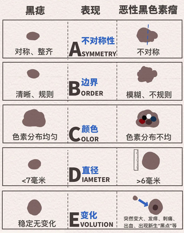 ABCDE法則示意圖。重慶松山醫(yī)院供圖