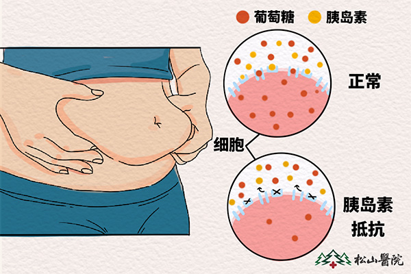 黑棘皮病的病因。重慶松山醫(yī)院供圖