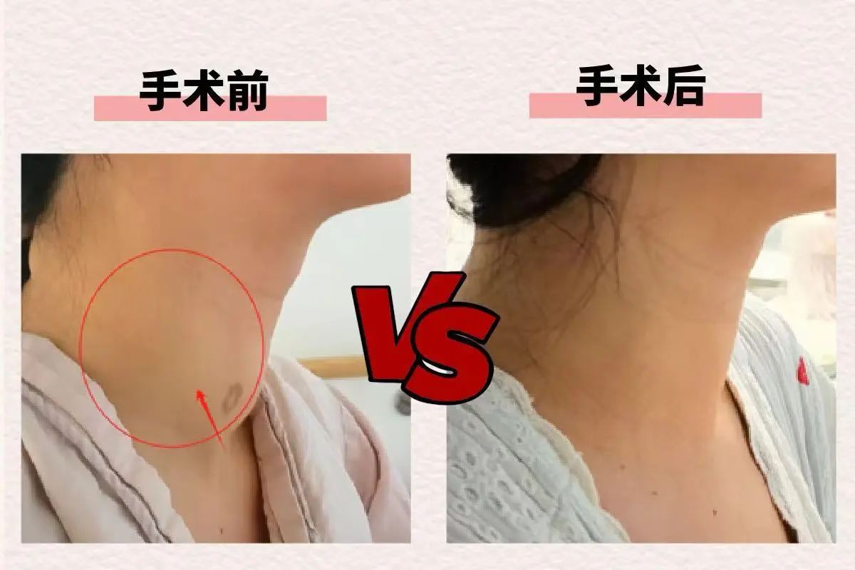 術(shù)后情況。重慶松山醫(yī)院供圖