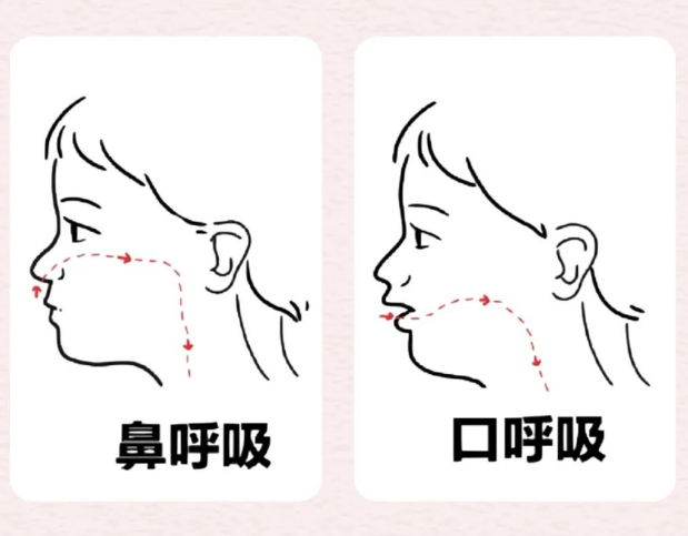口呼吸和鼻呼吸。重慶松山醫(yī)院供圖