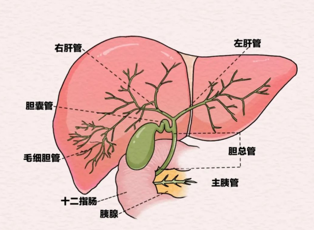 膽結(jié)石。重慶松山醫(yī)院供圖